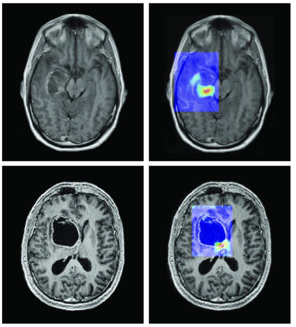 Quan la intel·ligència artificial redissenya l’economia: quina és la meva responsabilitat?
